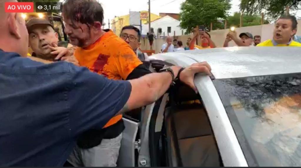 BARBÁRIE – Cid Gomes foi baleado por policiais em motim no Ceará