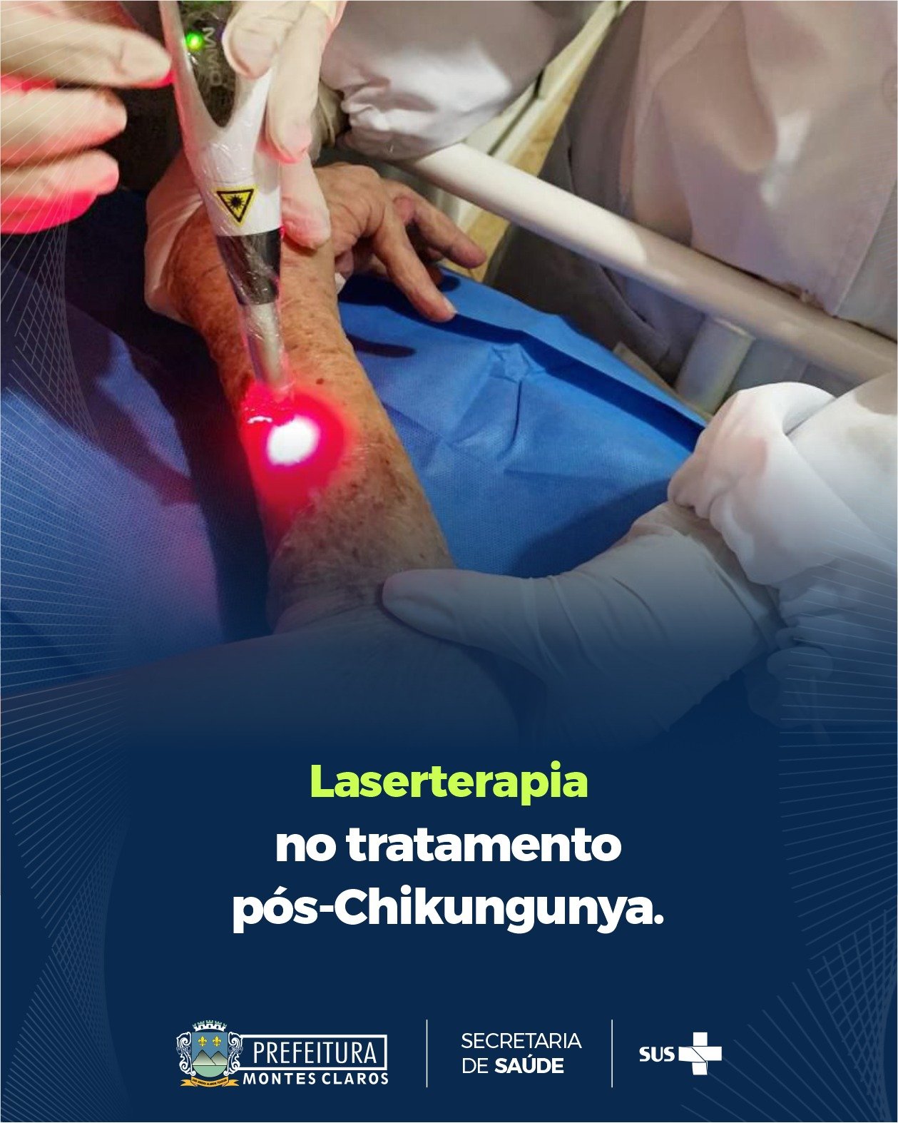 Montes Claros oferece laserterapia para combater as dores da chikungunya